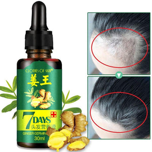 30ml Hair Loss Treatment Ginger Hair Care Growth Essence Oil for Men